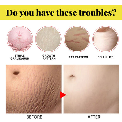 Skin Care Cream, Pregnant Women's Body Skin Gentle Repair Daily Care Moisturizing Moisturizer
