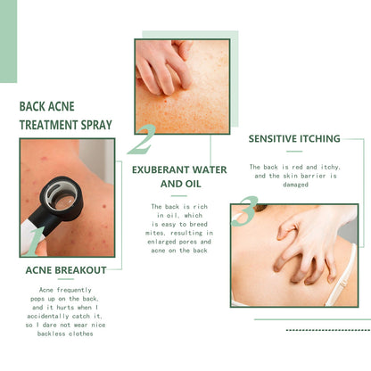 Body Acne Removal Cleanser Spray, Deep Clean Back Arm Fade Acne Beauty Moisturizing Spray