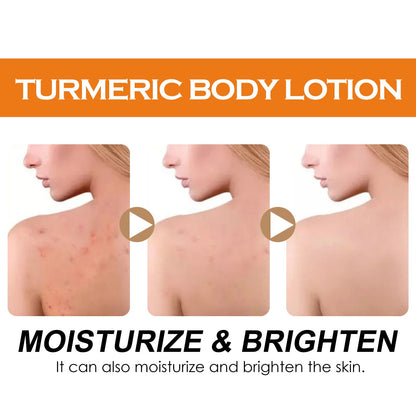 Turmeric Body Lotion, Moisturizing And Moisturizing Whitening Skin Refreshing And Brightening Winter Skin Care Body Lotion