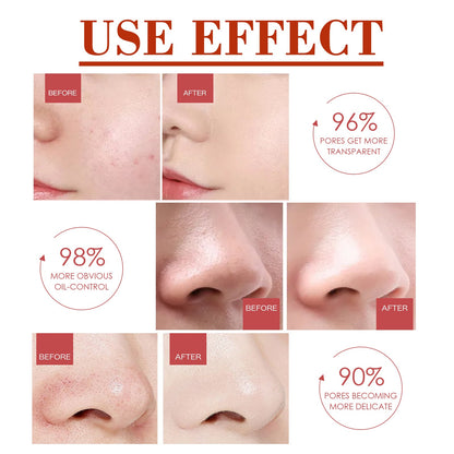 Pore Minimizer Serum, Pore Minimizer Moisture To Deep Clean Pores Carry Bright Moisturizing Essence Serum