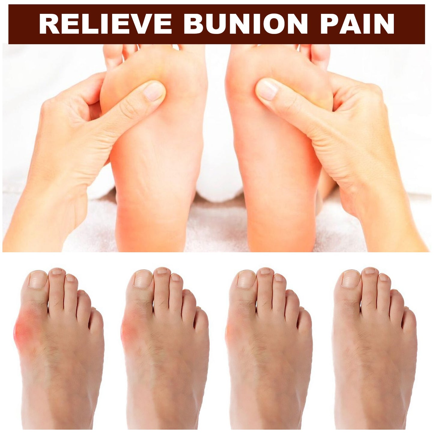 Bunion Essential Oil Roller For Pain Relief Massage Essential Oil Ball Foot Care Convenient Correction Of Thumb Valgus