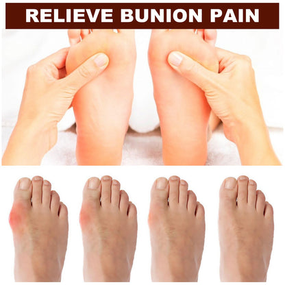 Bunion Essential Oil Roller For Pain Relief Massage Essential Oil Ball Foot Care Convenient Correction Of Thumb Valgus