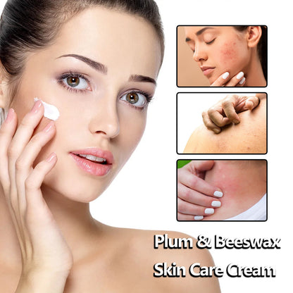 Beeswax Skin Cream Moisturizes Skin, Relieves Dry Skin, Sunburn, Mosquito Bites And Itch Relief Cream
