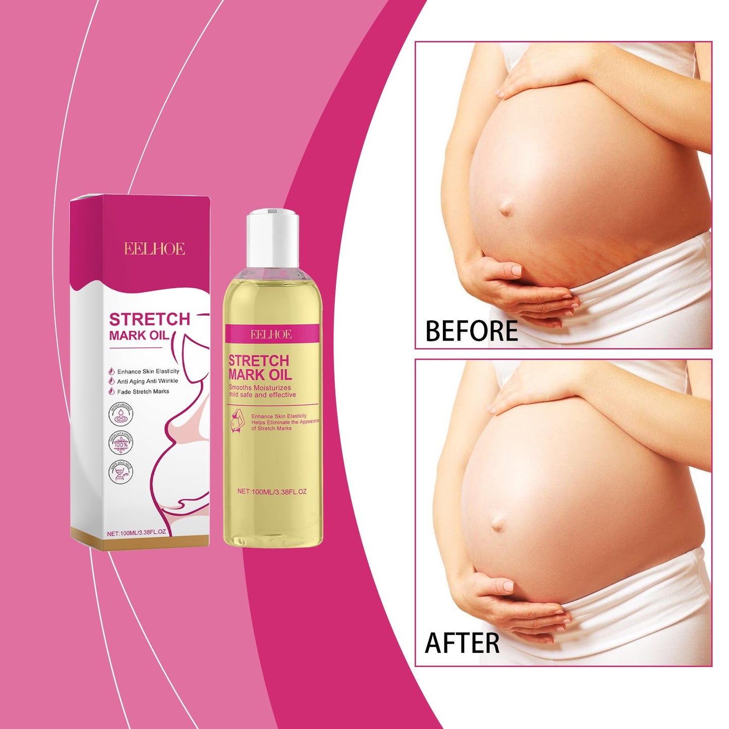 Skin Care Oil, Gentle, Nourishing And Improving Skin Care Oil For Postpartum Mothers