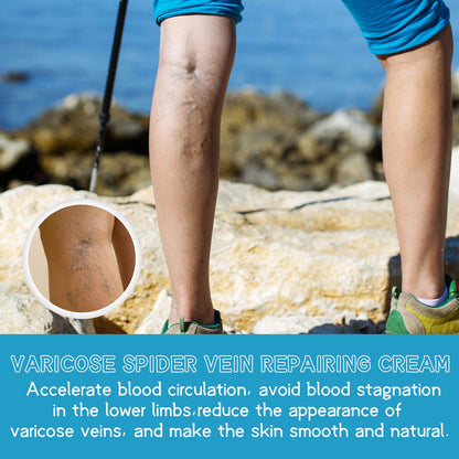 Varicose Spider Vein Repairing Cream, Relief Leg Pain Earthworm Leg Veins Care Massage Cream