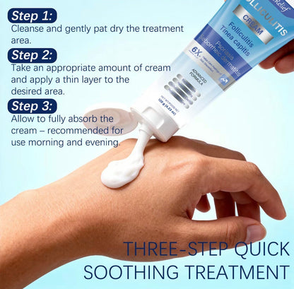 Follicalm Soothing Skin Cream