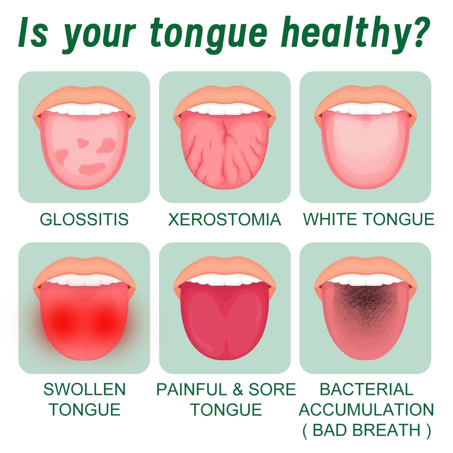 Tongue Repair Spray Repair Tongue Whitening To Relieve Dry, Cracked And Swollen Tongue Oral Care Spray