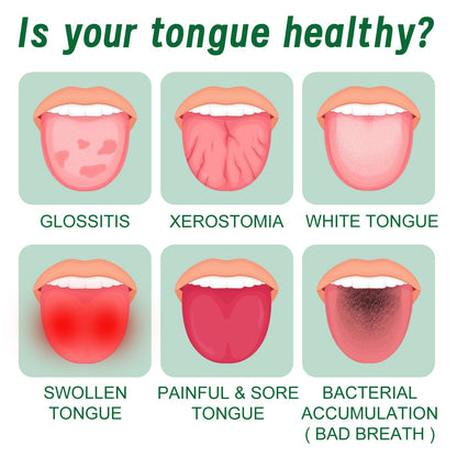 Tongue Repair Spray Repair Tongue Whitening To Relieve Dry, Cracked And Swollen Tongue Oral Care Spray