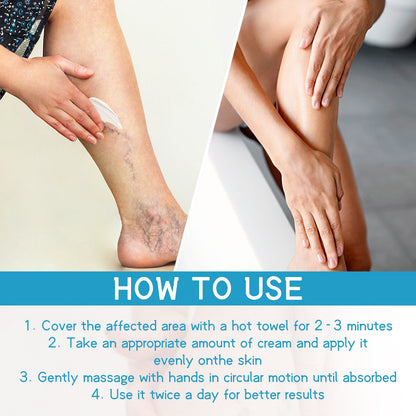 Varicose Spider Vein Repairing Cream, Relief Leg Pain Earthworm Leg Veins Care Massage Cream