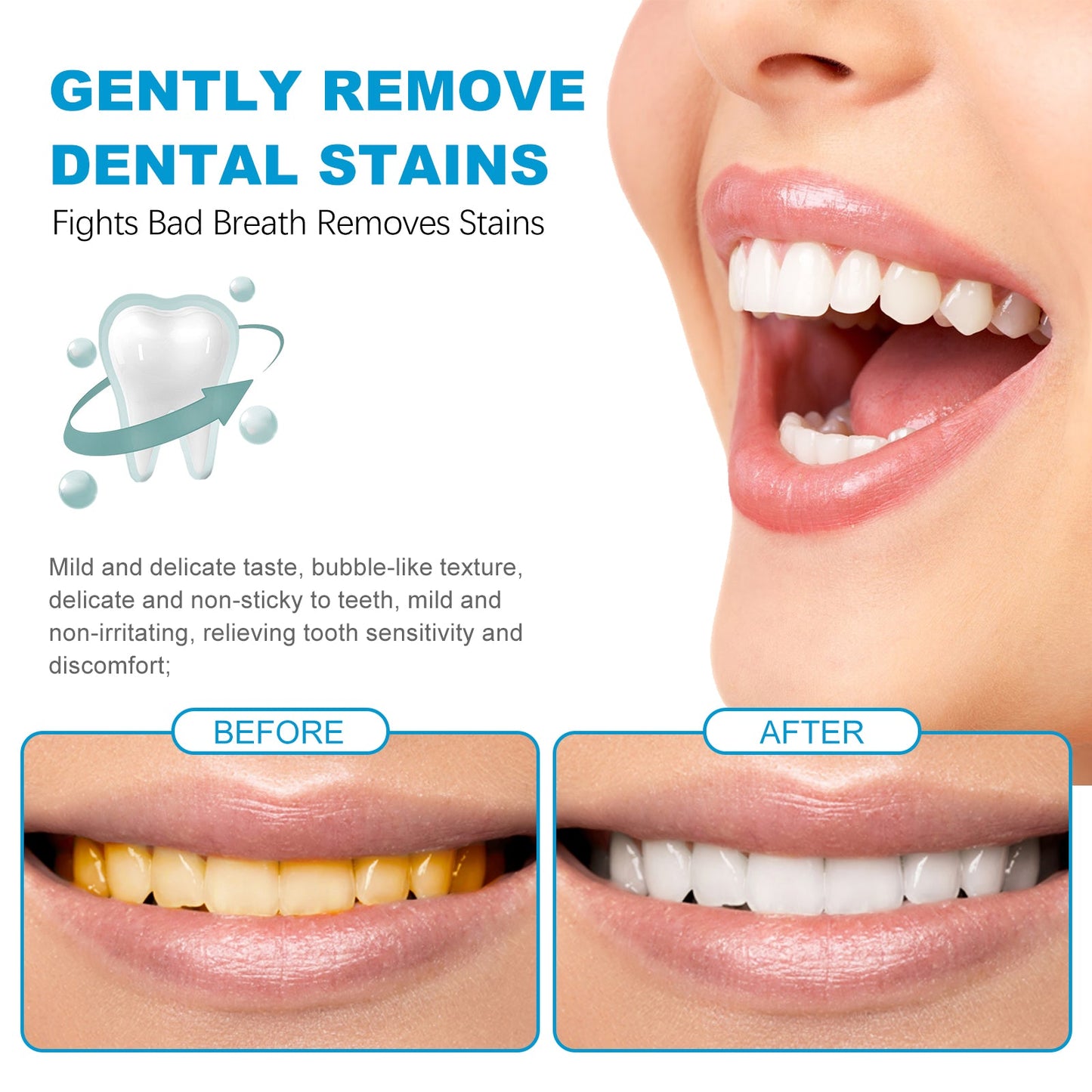 Mouth Mousse Toothpaste Teeth Clean Teeth Remove Tartar Stains Yellow Teeth Whitening Teeth Fresh Breath