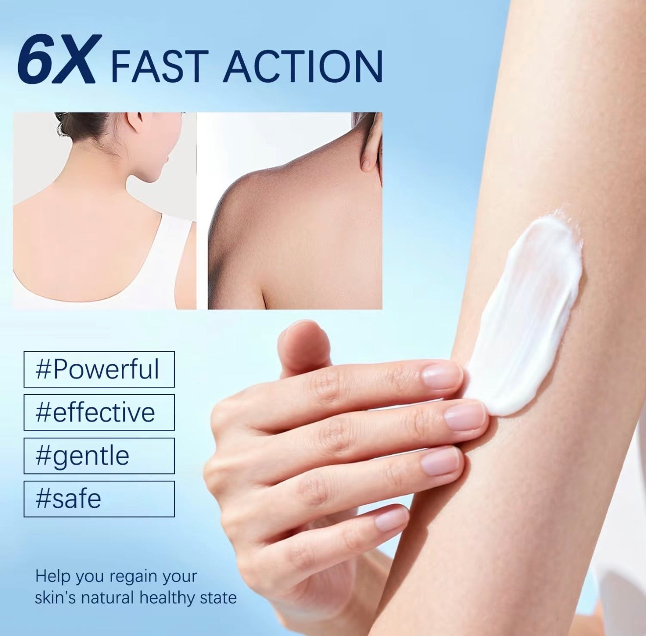 Follicalm Soothing Skin Cream