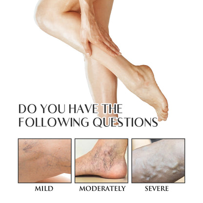 Varicose Veins Soothing Spray, Relief Of Sore Leg Muscles Massage Repair Earthworm Leg Vein Treatment Spray