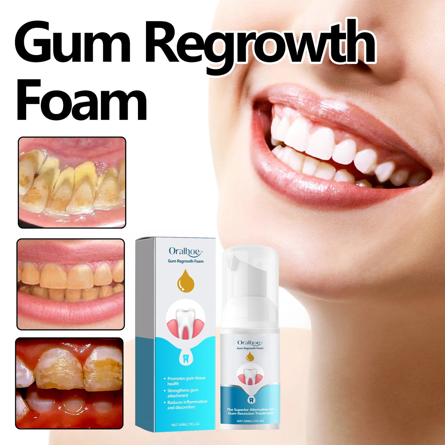 oralhoe Gum Regrowth Foam, Clean Teeth Tartar Care Gums Clean Teeth Anti-Moth Fresh Breath Mousse