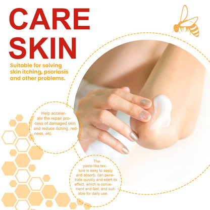 Bee-Poison Cowhide Moss Cream, Which Relieves Redness And Itchiness Of Skin