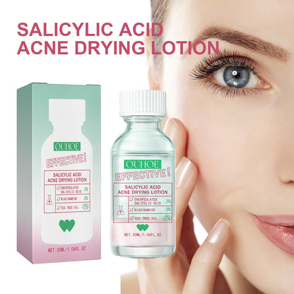 Salicylic Acid Acne Drying Lotion, Gentle Repair Acne-Skin Skin Moisturizing Lotion