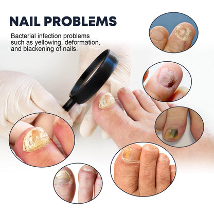 Nail Care Spray, To Reduce Brittle Nails By Layering Nail Strengthening Moisturizing Nutrient Solution