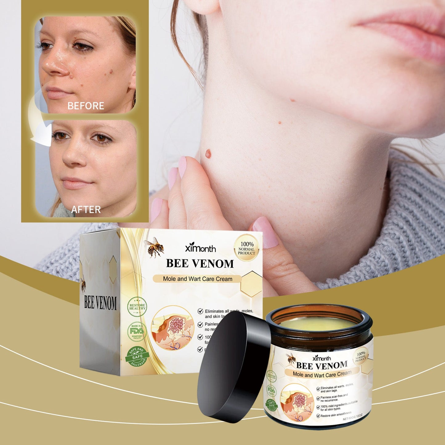 Mole And Wart Care Cream, Soft And Smooth Skin Moisturizing And Repairing Skin Care Cream