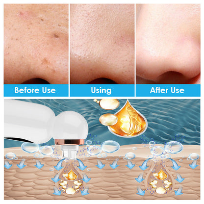 New Hailicare Small Bubble Suction Blackhead Instrument Skin Pore Cleaner Water Oxygen Circulation Skin Cleaning Instrument