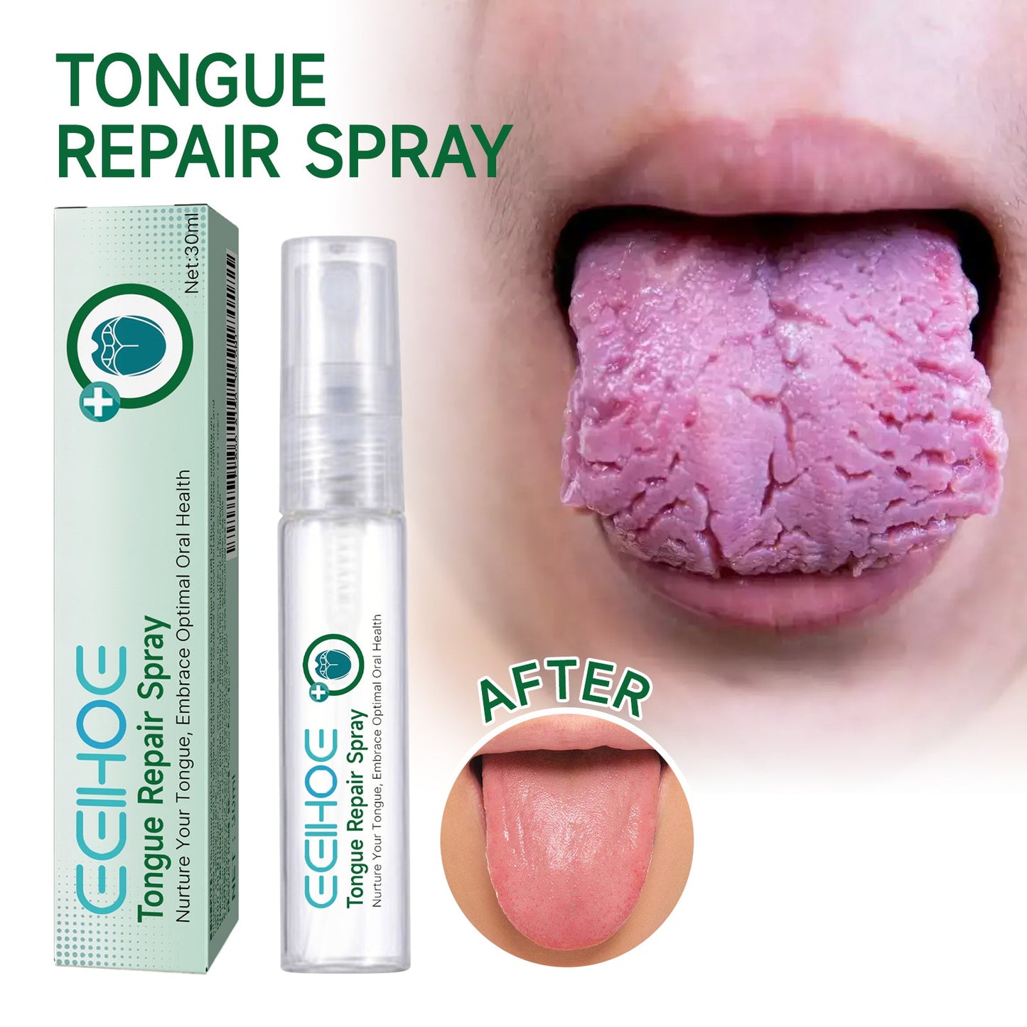 Tongue Repair Spray Repair Tongue Whitening To Relieve Dry, Cracked And Swollen Tongue Oral Care Spray