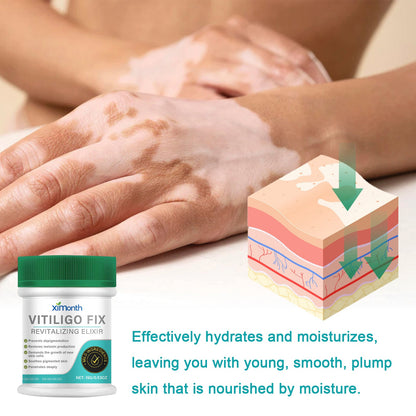 Vitiligo Fix Revitalizing Elixir, Lighten Skin Spots Even Skin Tone Moisturizing Body Care Repair Cream