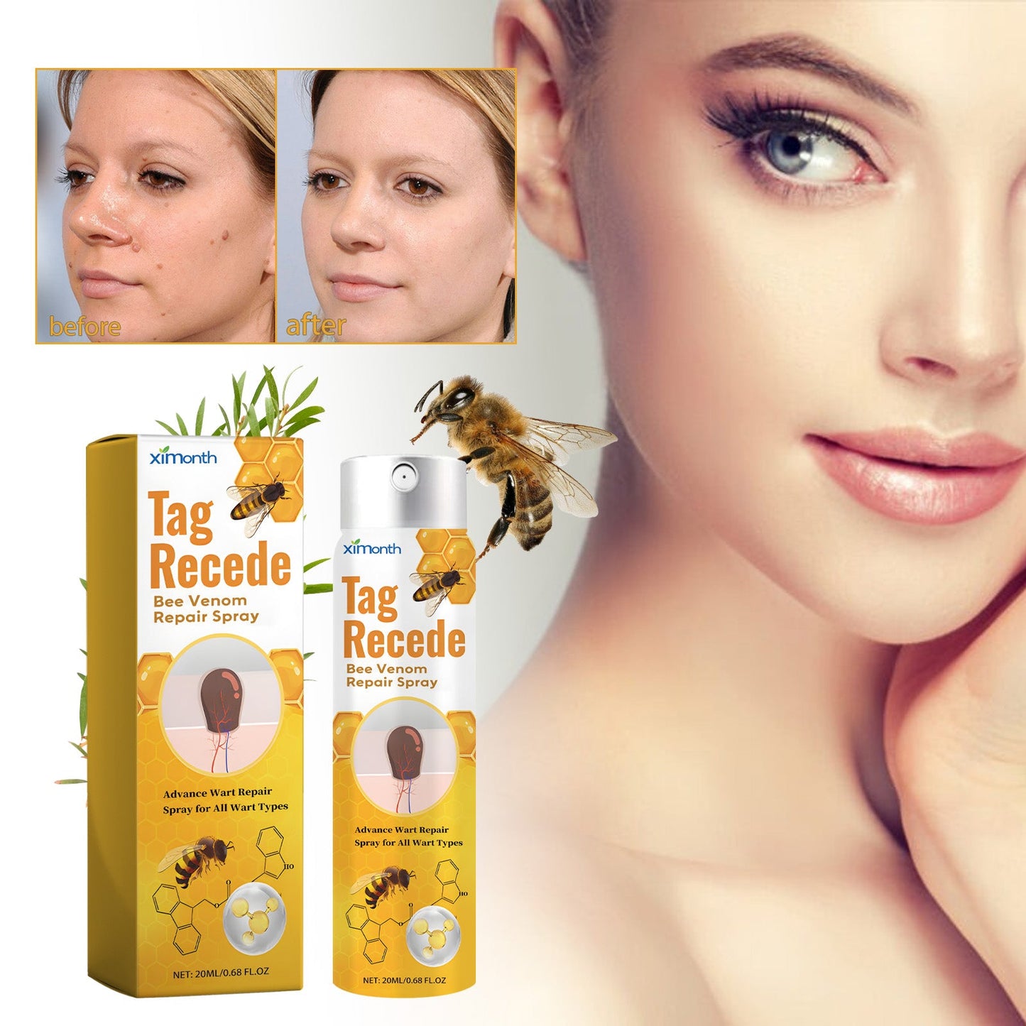Bee Venom Wart Treatment Spray Improves Pimples, Moles, Repairs and Smooths Skin Wart Treatment Spray