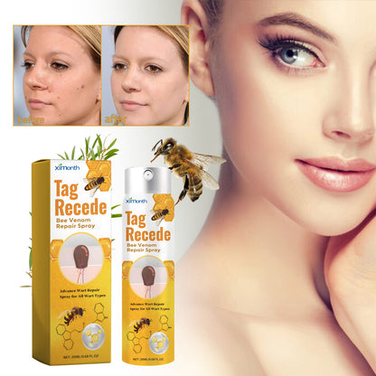 Bee Venom Wart Treatment Spray Improves Pimples, Moles, Repairs and Smooths Skin Wart Treatment Spray