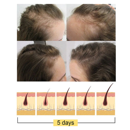 Ginger Dense Hair Soap, Moisturizes Hair Ends And Roots Cleansing Scalp Hair Care Shampoo Soap