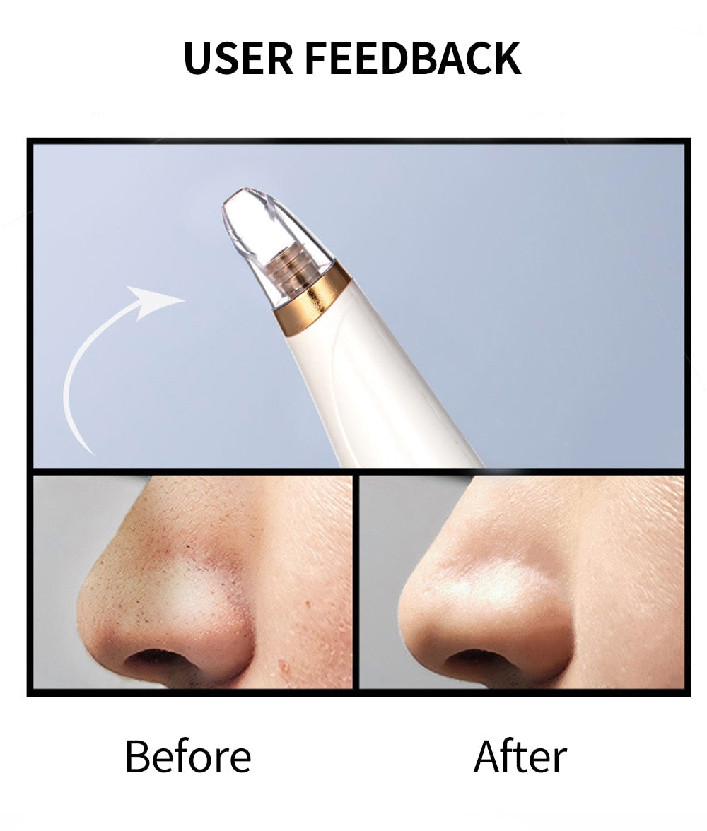 Blackhead Remover Face Deep Pore Cleaner Removal Vacuum Suction Facial SPA Diamond Beauty Care Tool Skin Care