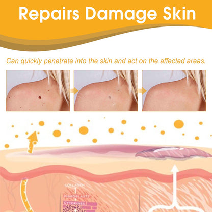 Bee Venom Wart Treatment Spray Improves Pimples, Moles, Repairs and Smooths Skin Wart Treatment Spray