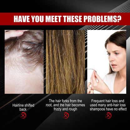 Black Rice Hair Spray Strengthen And Strengthen Hair Dense Hair Hydrating Repair Root Soft Hair Growth Spray