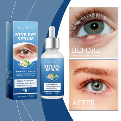 Eye Care Solution, A Gentle Moisturizing Eye Solution That Relieves Acidness, Is A Daily Portable Eye Care Drops