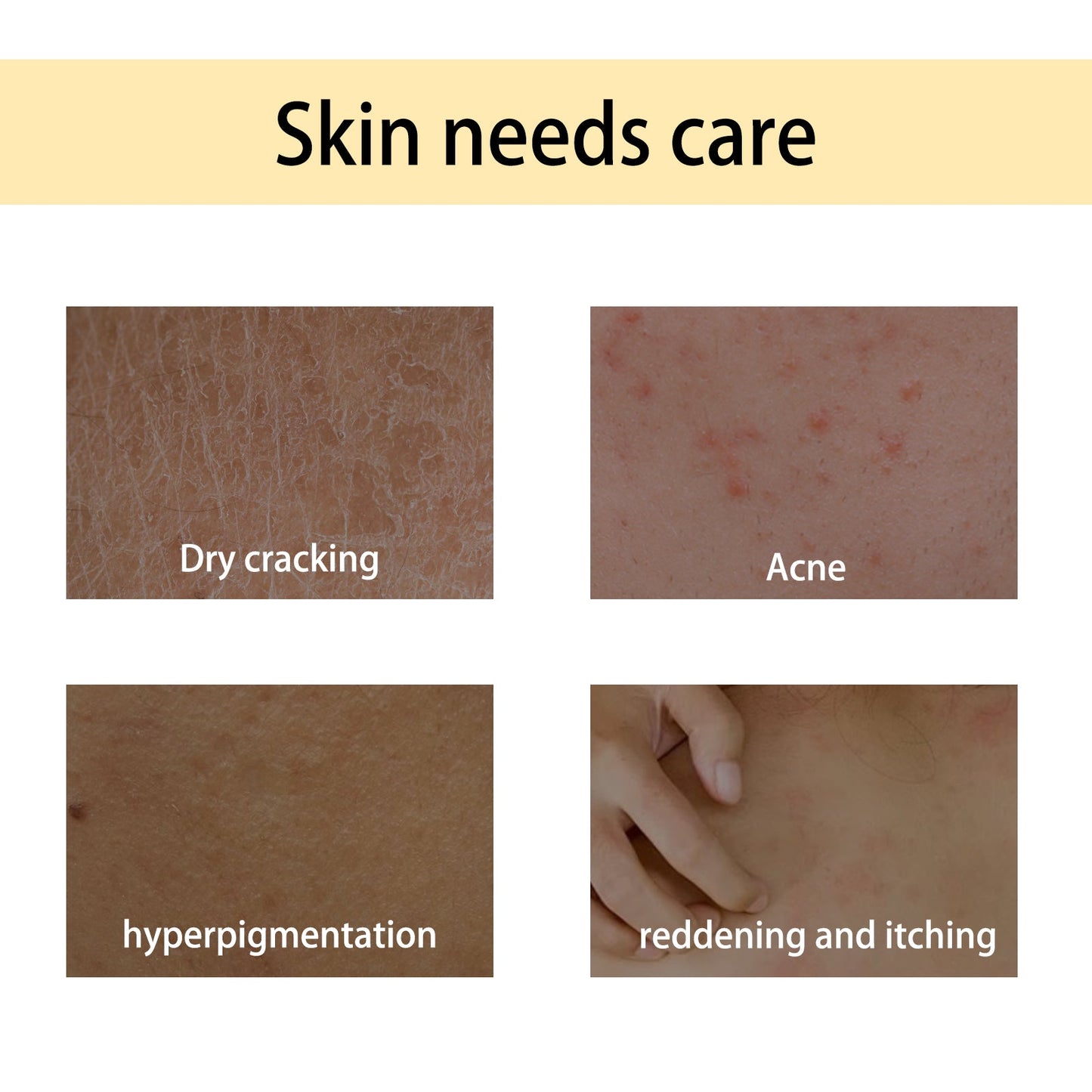 Handcrafted Body Oil, Slimming Massage Moisturizing And Firming Skin Body Care Essential Oil