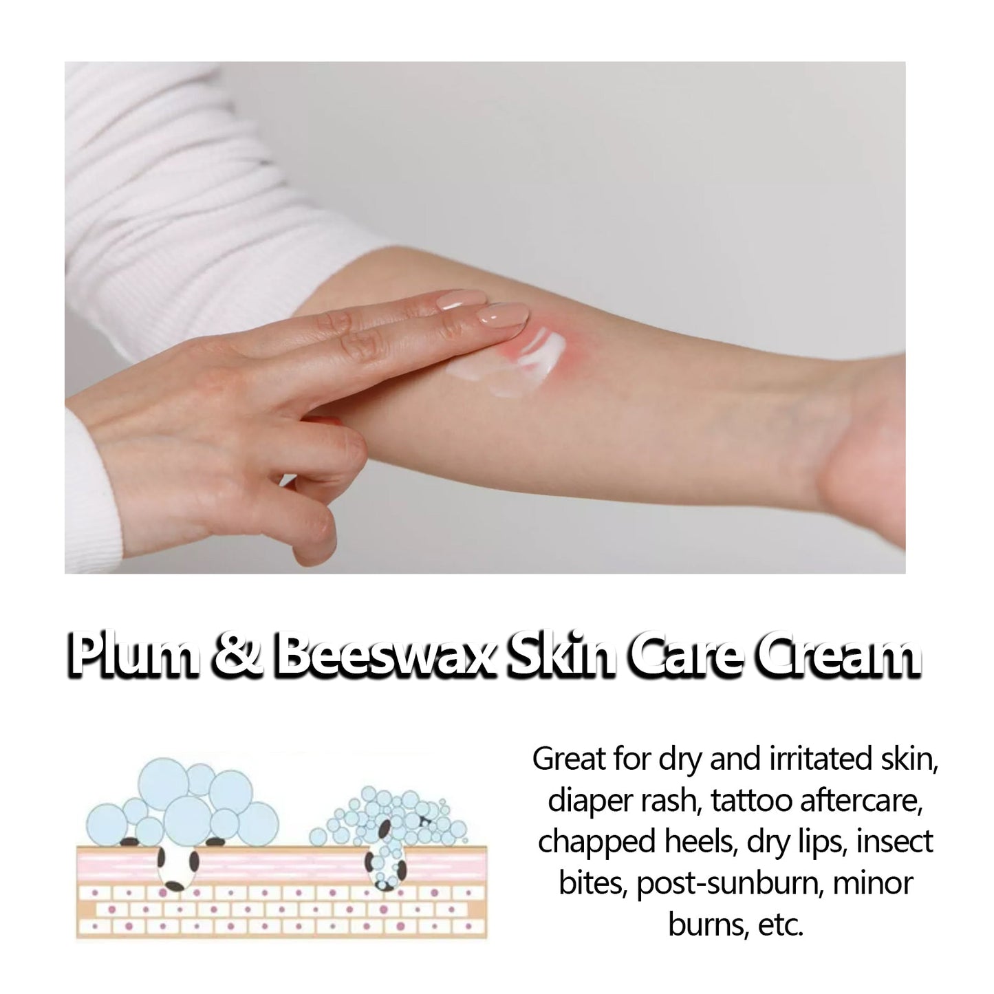 Beeswax Skin Cream Moisturizes Skin, Relieves Dry Skin, Sunburn, Mosquito Bites And Itch Relief Cream