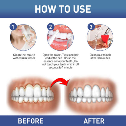 WestMonth Gum Instant Soothing Gel, Relieve Gums Swelling And Pain Clean Teeth Plaque Stains And Whiten Teeth Gel