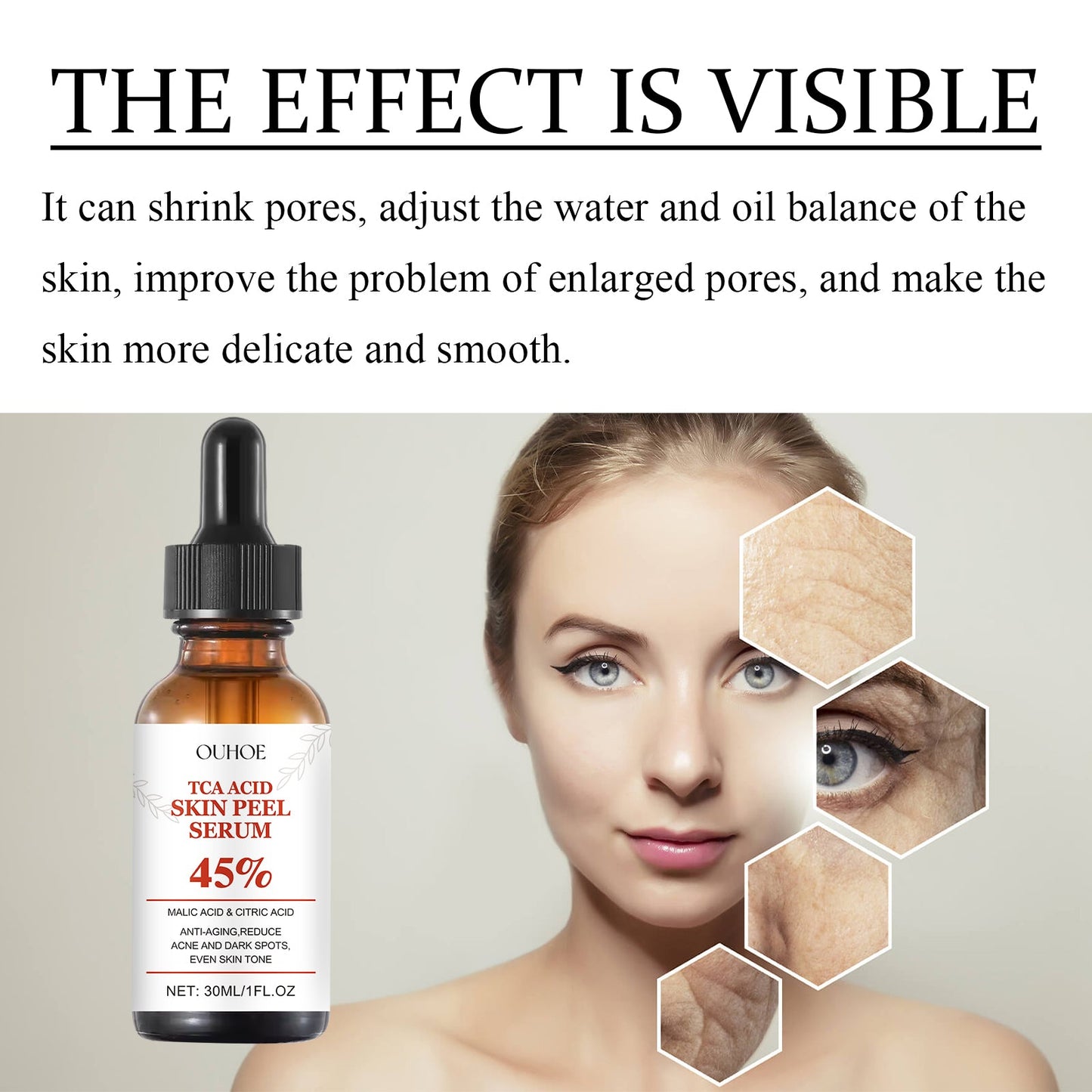 TCA Acid Skin Peel Serum