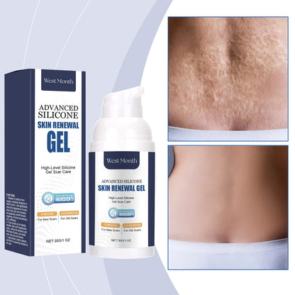 Skin Repair Gel, Gently Nourishes Body Skin And Naturally Shines Skin Repair Gel