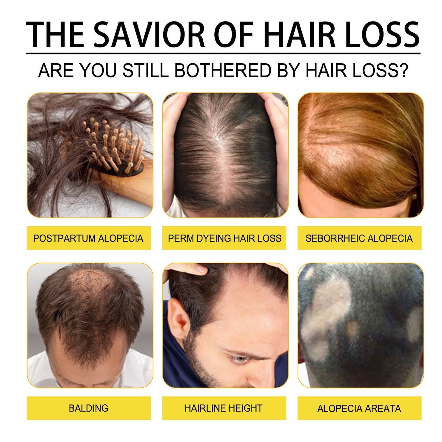 Black Seed Oil Essence To Improve Dry Hair, Nourish And Repair Damaged Hair And Prevent Hair Loss
