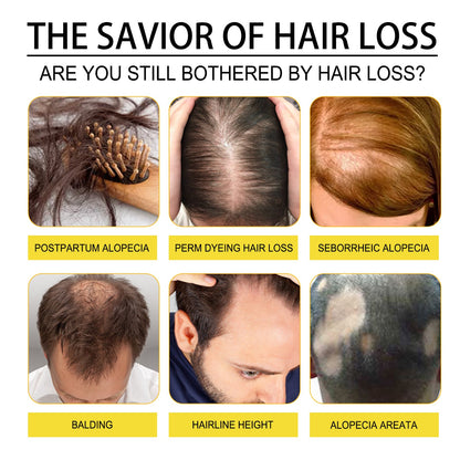 Black Seed Oil Essence To Improve Dry Hair, Nourish And Repair Damaged Hair And Prevent Hair Loss