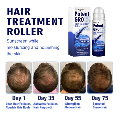 HOEGOA Hair Treatment Roller, Repair Strong And Firm Hair Moistening Hair Roots Thick, Smooth And Dense Hair Care Ball