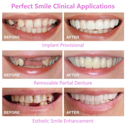 Upper Teeth And Lower Teeth Simulation Braces Non-Porous Braces Whitening Sleeves Second-Generation Silicone Simulation Teeth Dentures