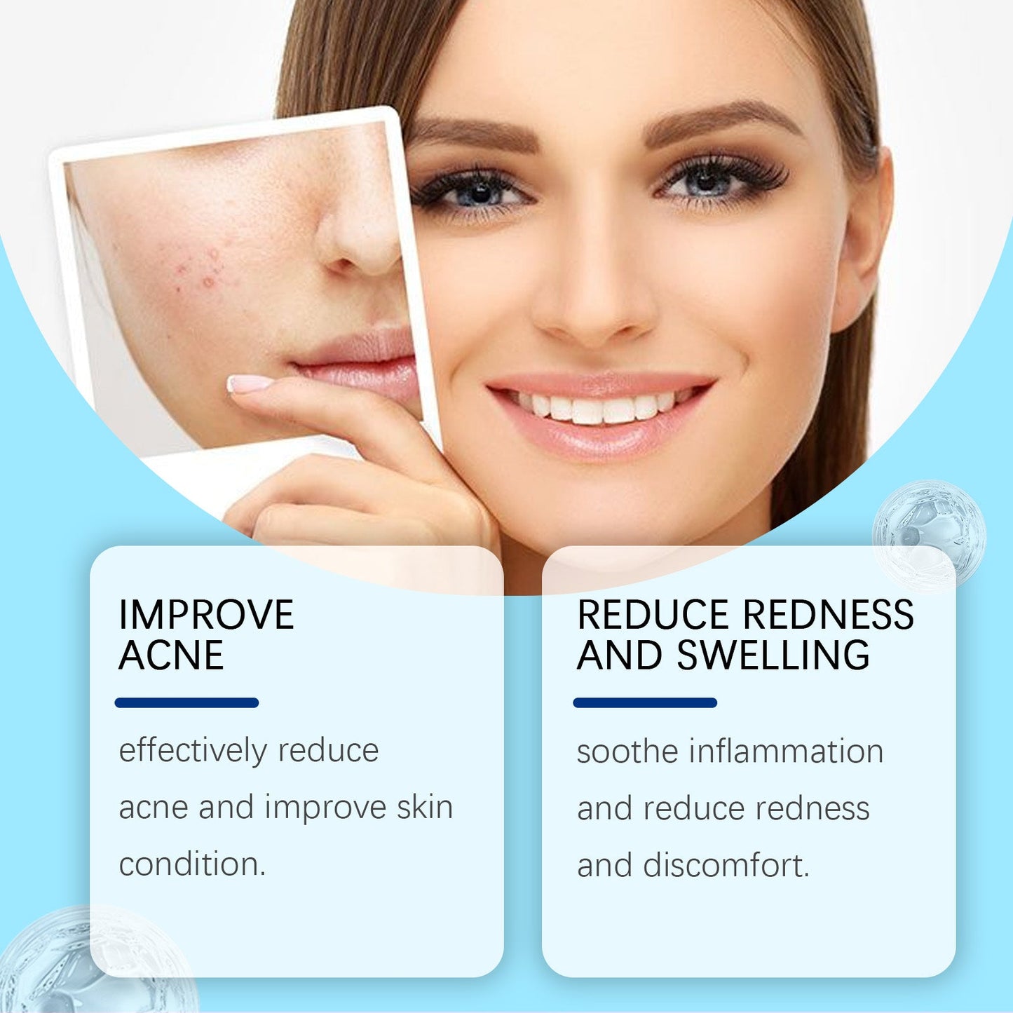 Retinol Gel Gently Cleanses Face Acne Care And Improves Skin Gel