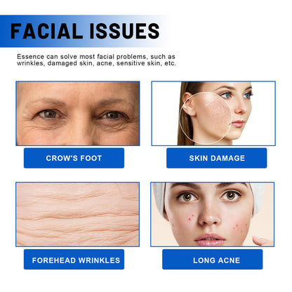 Blueberry Facial, Care Facial Skin Deep Cleansing Anti-Wrinkle Skin Care Essence Beauty Brightening Cream