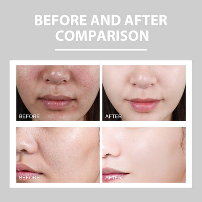 Hydrating Cream Hydrating And Lightening Facial Acne Repair Redness Hydrating And Brightening Moisturizing Cream