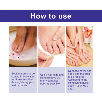 Nail Repair Lotion, Repair Thickening Nail Inlay Gray Nail Shine Soft Nail Care Solution