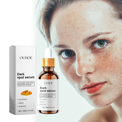 Dark Spot Serum, Hydrating Moist Firming Facial Skin Repair Skin Dark Bright Skin Care Essence