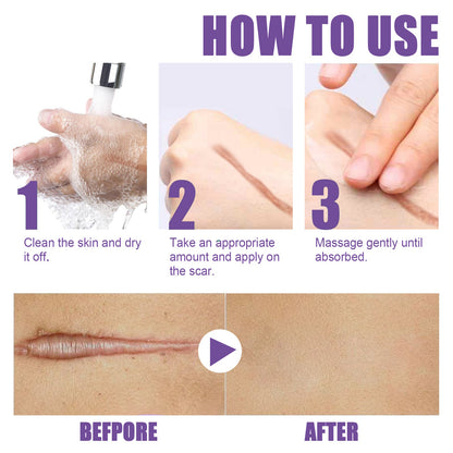 Skin Care Cream, Daily Moisturizing, Smoothing And Firming Skin Repair Postpartum Repair Topical Cream