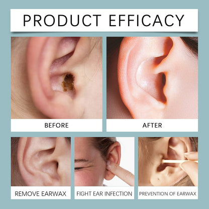 Anti Cochlear Blockage Removal Spray, Daily Gentle And Soothing Moisturizing Earwax Cleaning And Care Spray