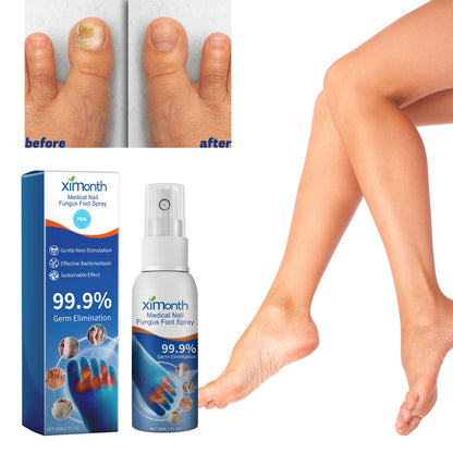 Medical Nail Fungus Foot Spray, Repair Thickening Gray Nail Rot Foot Moisturizing And Cleansing Armor