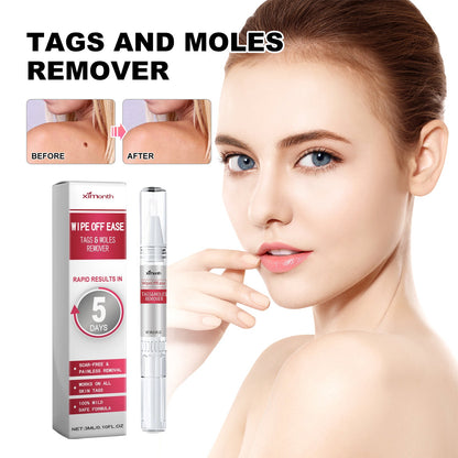 Skin Wart Lotion, Cleanses Skin And Removes Flat Eye Wart Lotion Especially Hand Cocoon