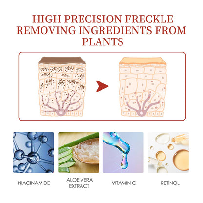 Pigment Repair Cream, Moisturizing And Lightening Freckles Dark Spots Spots Melasma Melanin Beauty Cream